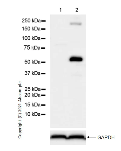 Western blot - Anti-Osteopontin antibody [RM1018] (AB283656)