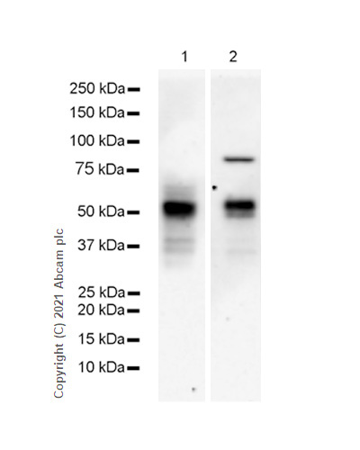 Western blot - Anti-Osteopontin antibody [RM1018] (AB283656), expandable thumbnail