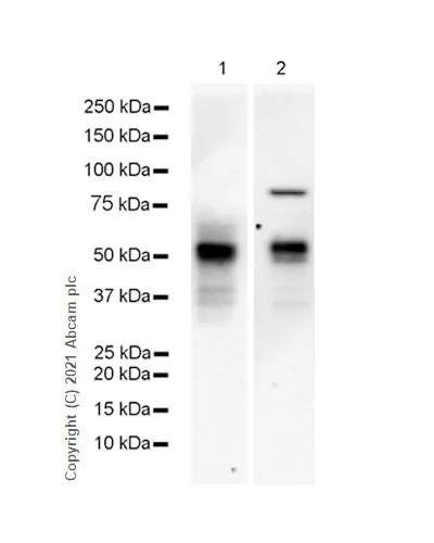 Western blot - Anti-Osteopontin antibody [RM1018] (AB283656)