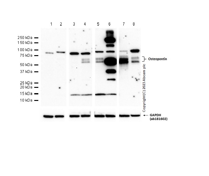 Western blot - Anti-Osteopontin antibody [RM1018] (ab283656), expandable thumbnail