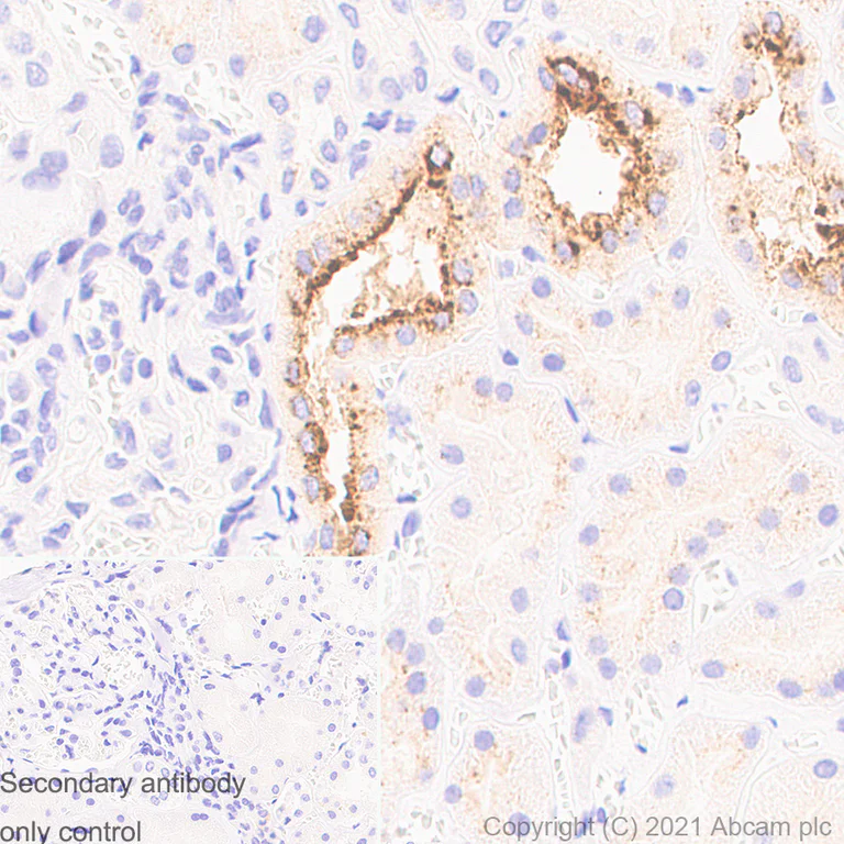 Immunohistochemistry (Formalin/PFA-fixed paraffin-embedded sections) - Anti-Osteopontin antibody [RM1018] - BSA and Azide free (AB283669)