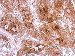 Immunohistochemistry (Formalin/PFA-fixed paraffin-embedded sections) - Anti-Osteoprotegerin antibody (AB183910)