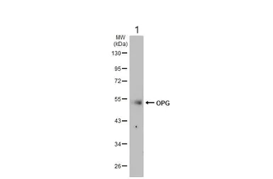 Western blot - Anti-Osteoprotegerin antibody (AB183910)