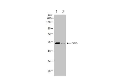 Western blot - Anti-Osteoprotegerin antibody (AB183910)