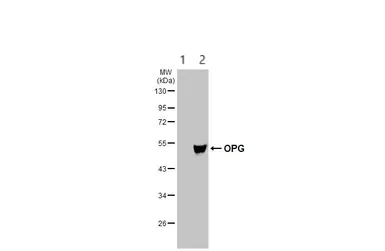 Western blot - Anti-Osteoprotegerin antibody (AB183910)