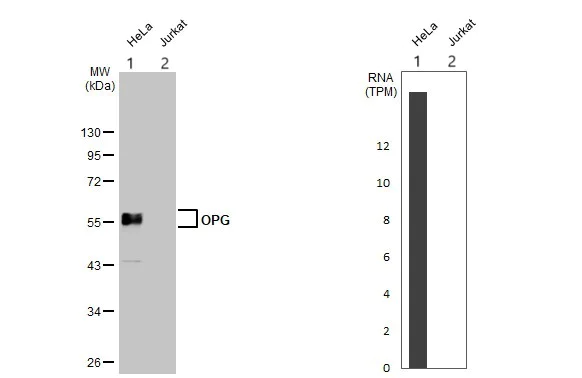 Western blot - Anti-Osteoprotegerin antibody (AB183910)