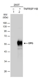 Western blot - Anti-Osteoprotegerin antibody (AB183910)