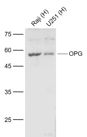 Western blot - Anti-Osteoprotegerin antibody (AB203061), expandable thumbnail