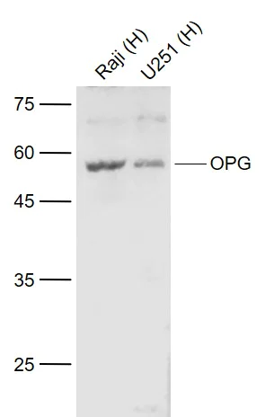 Western blot - Anti-Osteoprotegerin antibody (AB203061)
