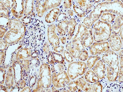 Immunohistochemistry (Formalin/PFA-fixed paraffin-embedded sections) - Anti-Osteoprotegerin antibody (AB73400)