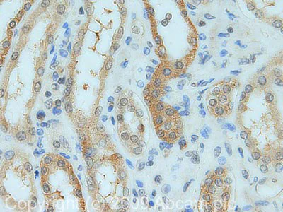 Immunohistochemistry (Formalin/PFA-fixed paraffin-embedded sections) - Anti-Osteoprotegerin antibody (AB73400)