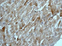 Immunohistochemistry (Formalin/PFA-fixed paraffin-embedded sections) - Anti-Osteoprotegerin antibody [EPR3592] (AB124820)