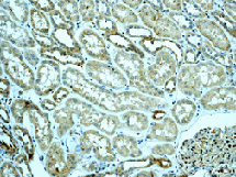Immunohistochemistry (Formalin/PFA-fixed paraffin-embedded sections) - Anti-Osteoprotegerin antibody [EPR3592] - BSA and Azide free (AB248021), expandable thumbnail