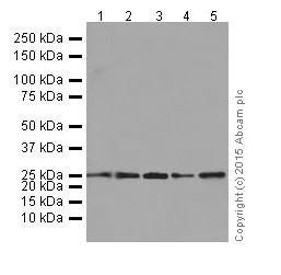 Western blot - Anti-OSTF1 antibody [EP15457] - BSA and Azide free (AB284856)