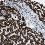 Immunohistochemistry (Formalin/PFA-fixed paraffin-embedded sections) - Anti-OSTM1 antibody (AB121327)