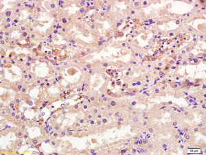 Immunohistochemistry (Formalin/PFA-fixed paraffin-embedded sections) - Anti-OSTM1 antibody (AB203629)