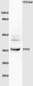 Western blot - Anti-OSTM1 antibody (AB203629)