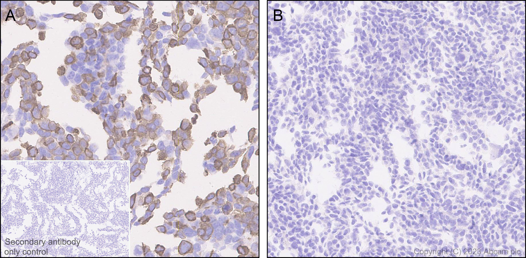 Immunohistochemistry (Formalin/PFA-fixed paraffin-embedded sections) - Anti-Otoferlin antibody [EPR28223-1] (AB309197), expandable thumbnail