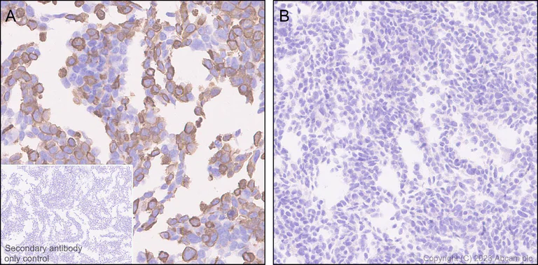 Immunohistochemistry (Formalin/PFA-fixed paraffin-embedded sections) - Anti-Otoferlin antibody [EPR28223-1] (AB309197)