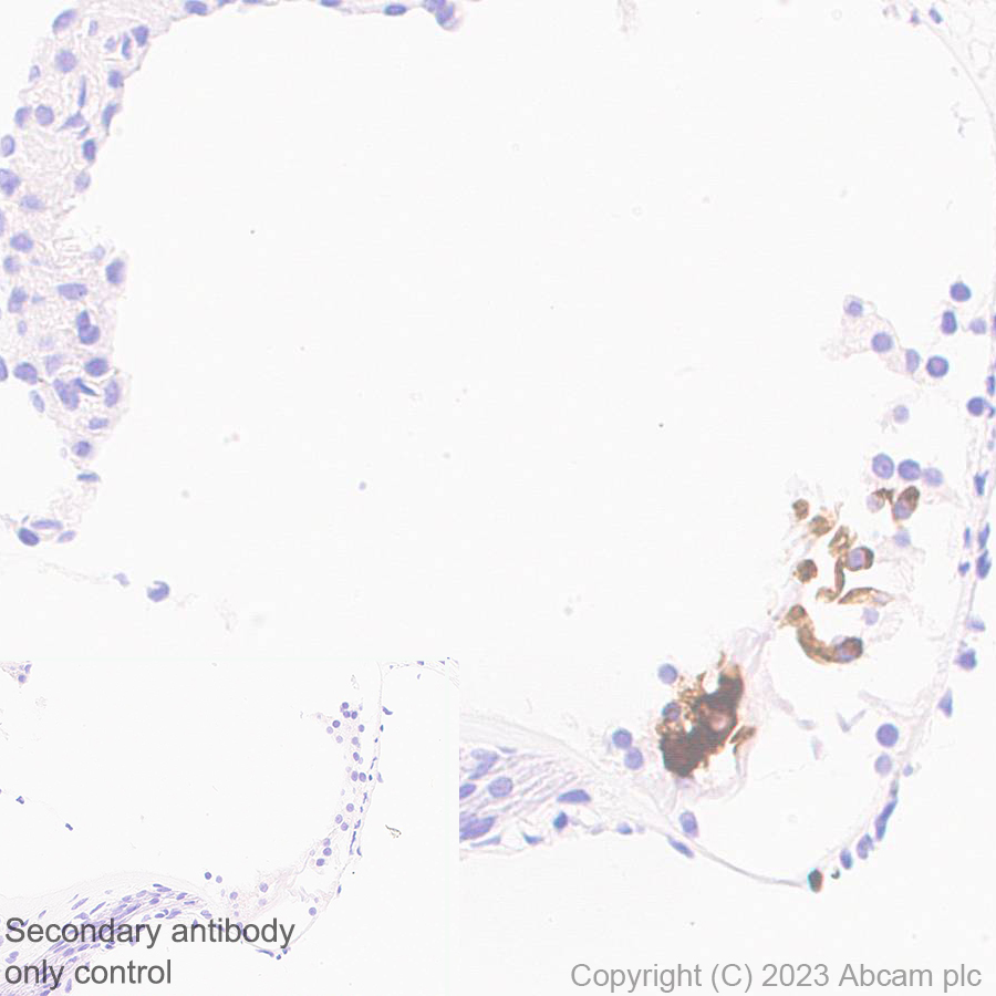 Immunohistochemistry (Formalin/PFA-fixed paraffin-embedded sections) - Anti-Otoferlin antibody [EPR28223-1] (AB309197), expandable thumbnail