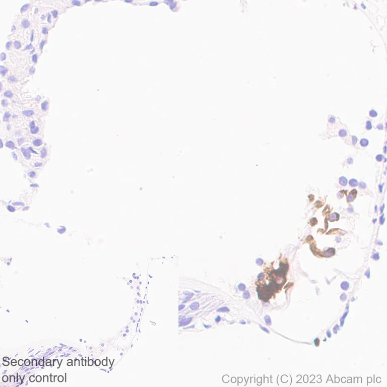 Immunohistochemistry (Formalin/PFA-fixed paraffin-embedded sections) - Anti-Otoferlin antibody [EPR28223-1] (AB309197)