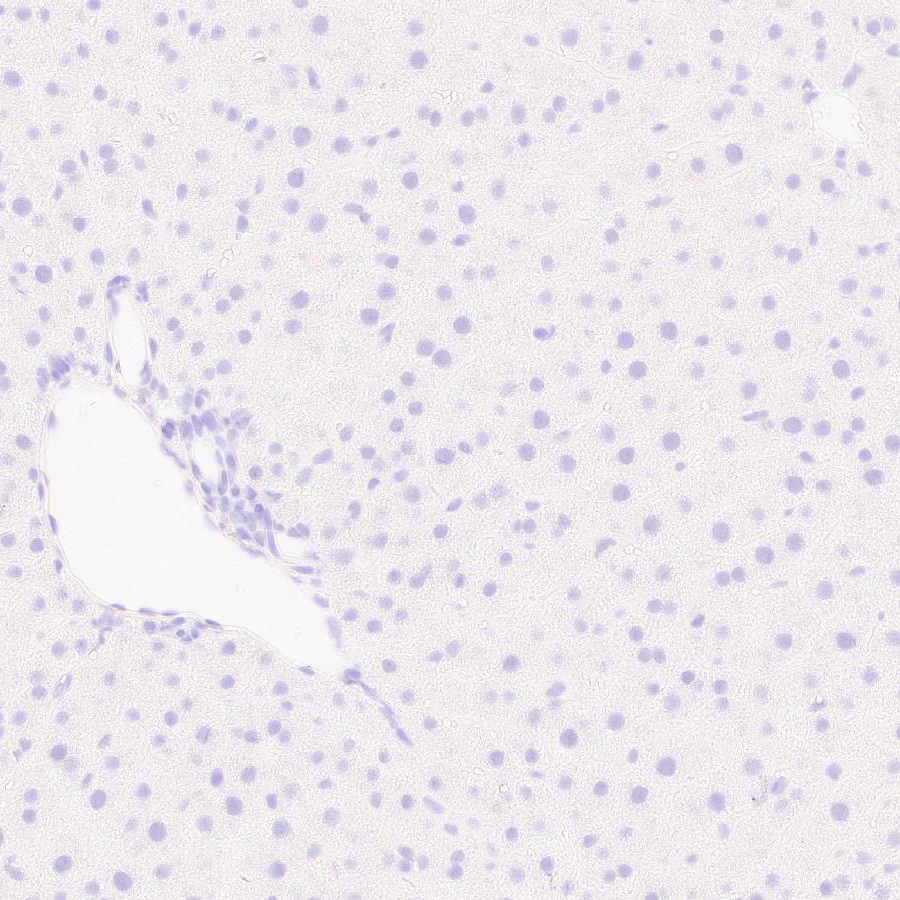 Immunohistochemistry (Formalin/PFA-fixed paraffin-embedded sections) - Anti-Otoferlin antibody [EPR28223-1] (AB309197), expandable thumbnail