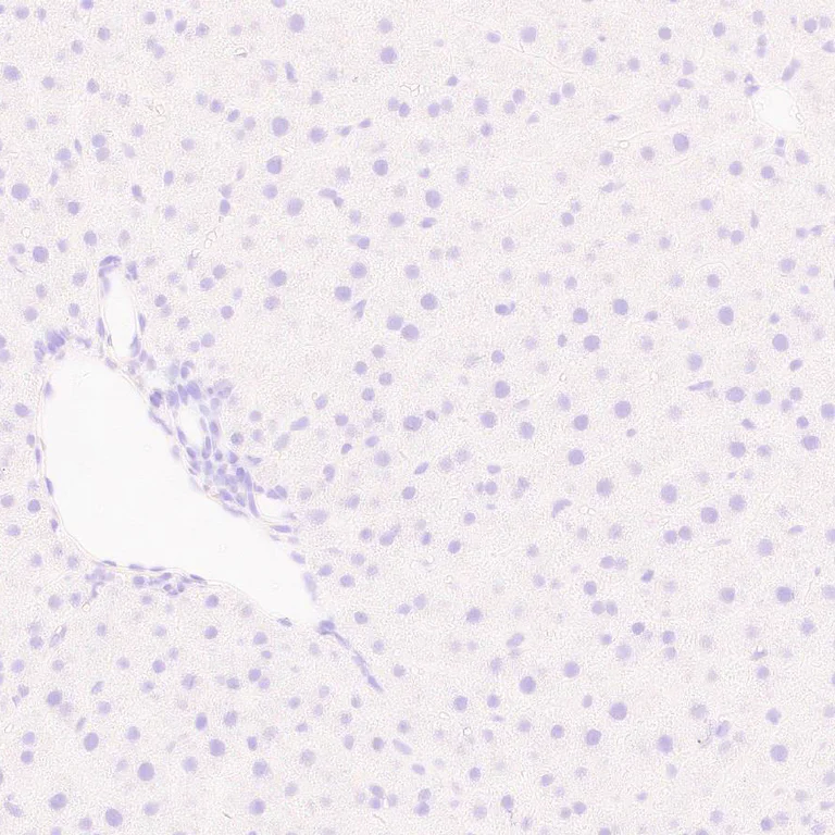 Immunohistochemistry (Formalin/PFA-fixed paraffin-embedded sections) - Anti-Otoferlin antibody [EPR28223-1] (AB309197)