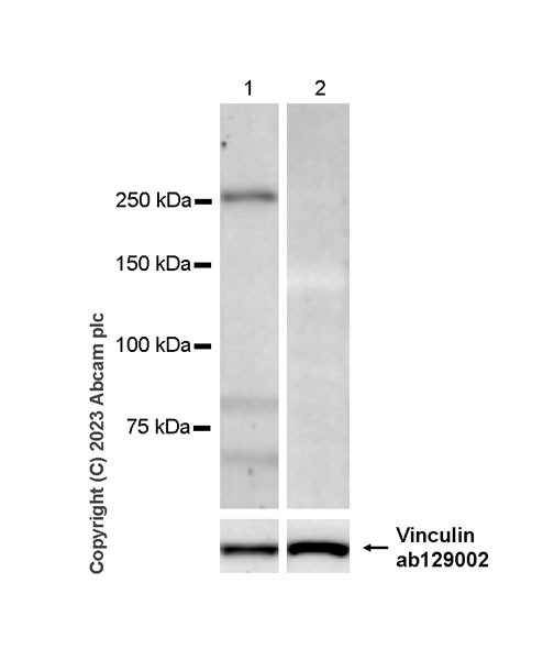 Western blot - Anti-Otoferlin antibody [EPR28223-1] (AB309197), expandable thumbnail