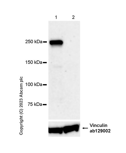 Western blot - Anti-Otoferlin antibody [EPR28223-1] (ab309197), expandable thumbnail