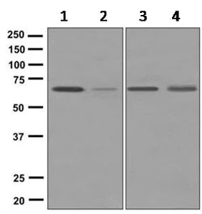 Western blot - Anti-OTOP2 antibody [EPR9484] (AB167167)