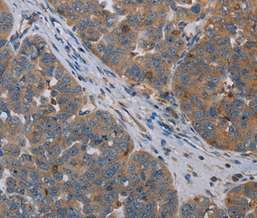 Immunohistochemistry (Formalin/PFA-fixed paraffin-embedded sections) - Anti-Otoraplin antibody - C-terminal (AB198781), expandable thumbnail