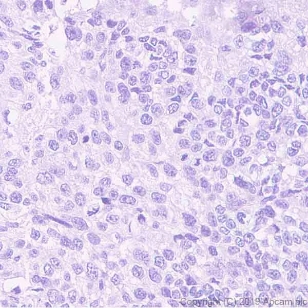 Immunohistochemistry (Formalin/PFA-fixed paraffin-embedded sections) - Anti-OTP antibody [EPR22178-17] - BSA and Azide free (AB256826)
