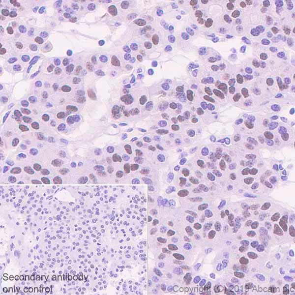 Immunohistochemistry (Formalin/PFA-fixed paraffin-embedded sections) - Anti-OTP antibody [EPR22178-17] - BSA and Azide free (AB256826)