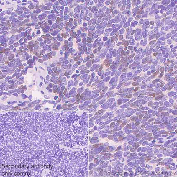Immunohistochemistry (Formalin/PFA-fixed paraffin-embedded sections) - Anti-OTP antibody [EPR22178-17] - BSA and Azide free (AB256826)