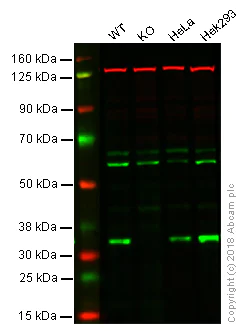 Western blot - Anti-OTUB1 antibody (AB101471)
