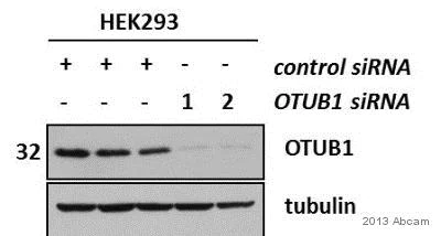 Western blot - Anti-OTUB1 antibody (AB82154)