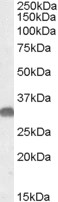Western blot - Anti-OTUB1 antibody (AB82154)