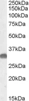Western blot - Anti-OTUB1 antibody (AB82154)