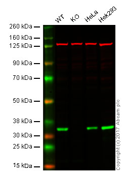 Western blot - Anti-OTUB1 antibody [EPR13028(B)] (AB175200), expandable thumbnail