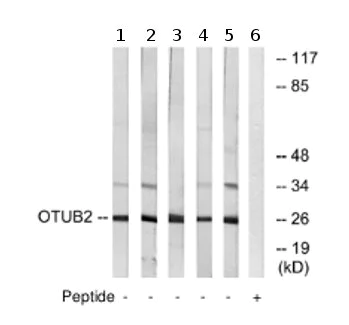 Western blot - Anti-OTUB2 antibody (AB74371)