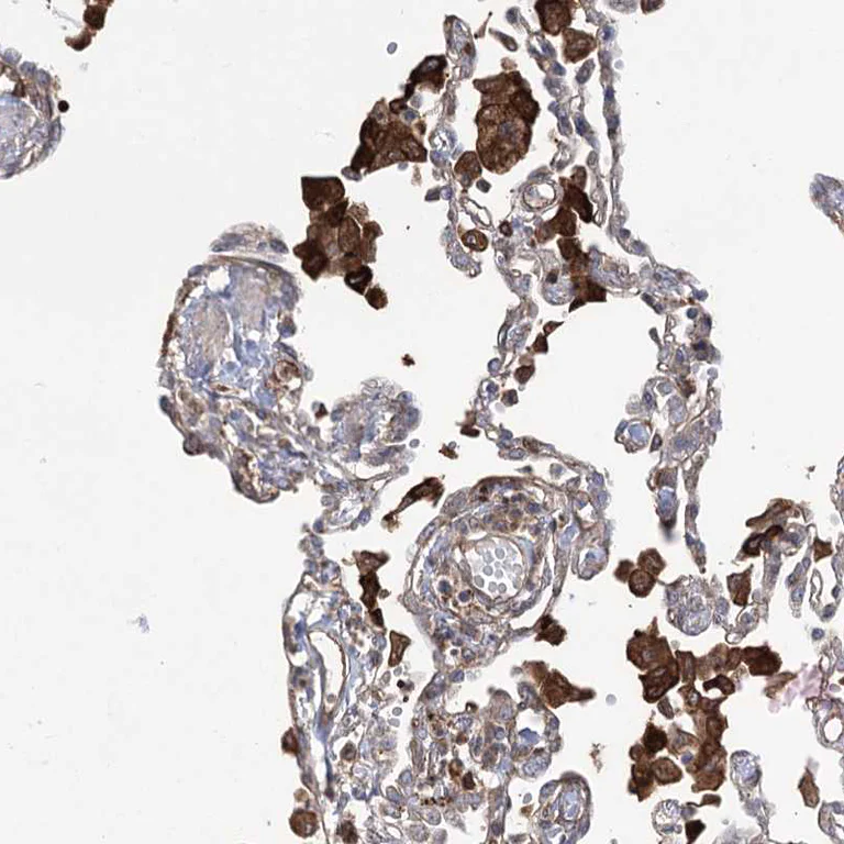 Immunohistochemistry (Formalin/PFA-fixed paraffin-embedded sections) - Anti-OTUD1 antibody (AB122481)