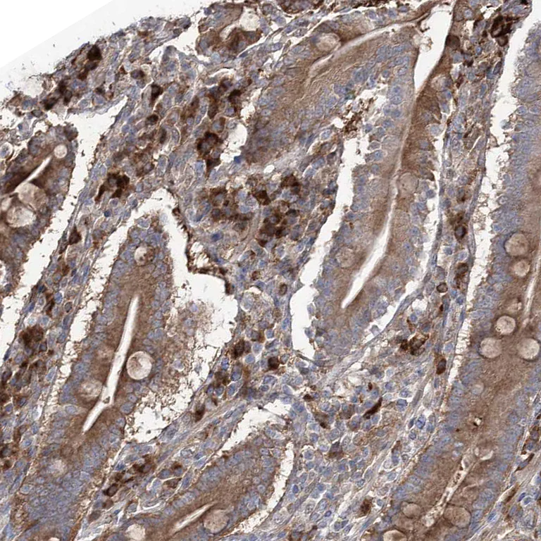 Immunohistochemistry (Formalin/PFA-fixed paraffin-embedded sections) - Anti-OTUD1 antibody (AB122481)