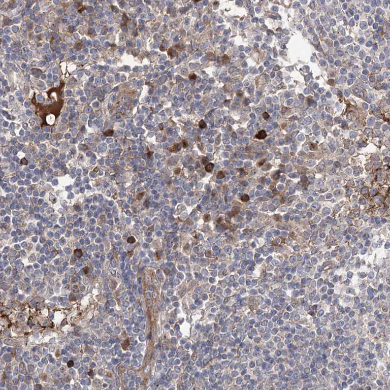 Immunohistochemistry (Formalin/PFA-fixed paraffin-embedded sections) - Anti-OTUD1 antibody (AB122481)
