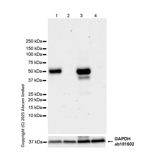Western blot - Anti-OTUD1 antibody [EPR30463-275] (AB325122)