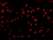 Immunocytochemistry/ Immunofluorescence - Anti-OTUD4/HIN-1 antibody (AB106368), expandable thumbnail