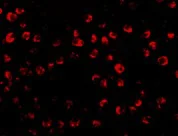 Immunocytochemistry/ Immunofluorescence - Anti-OTUD4/HIN-1 antibody (AB106368)