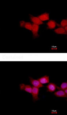 Immunocytochemistry/ Immunofluorescence - Anti-OTUD6B antibody (AB127714), expandable thumbnail
