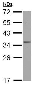 Western blot - Anti-OTUD6B antibody (AB127714), expandable thumbnail