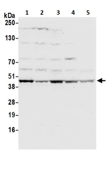 Western blot - Anti-OTULIN antibody (AB245652)