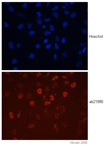Immunocytochemistry/ Immunofluorescence - Anti-Otx1 + Otx2 antibody (AB21990)